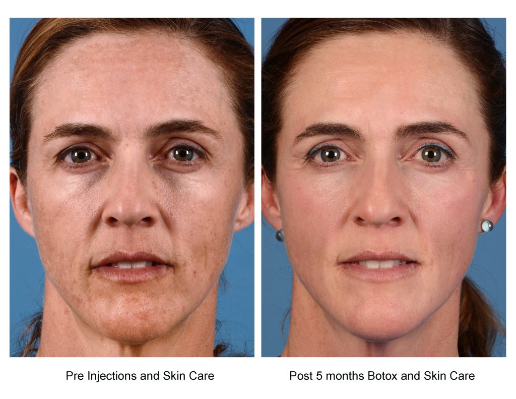 A real patient of Dr. Kenkel with dramatic skincare improvement results.