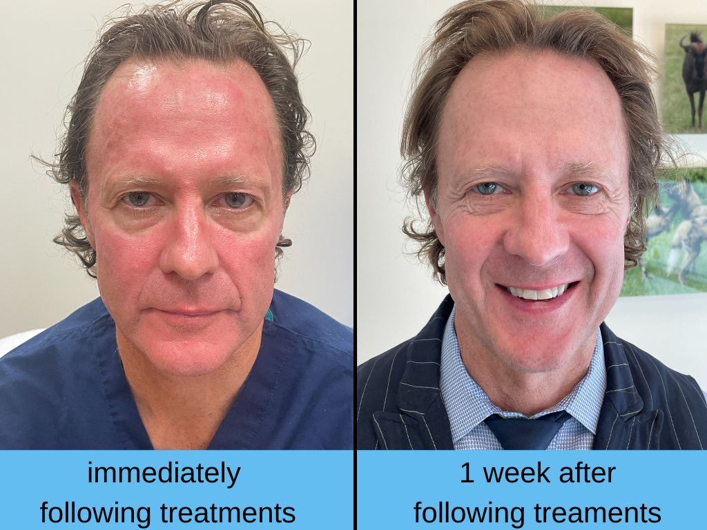 before and after treatments