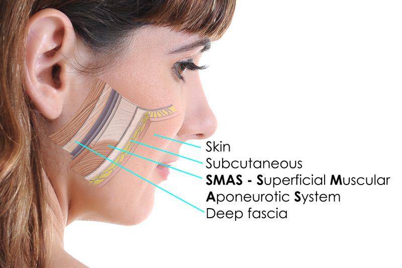 SMAS skin layers