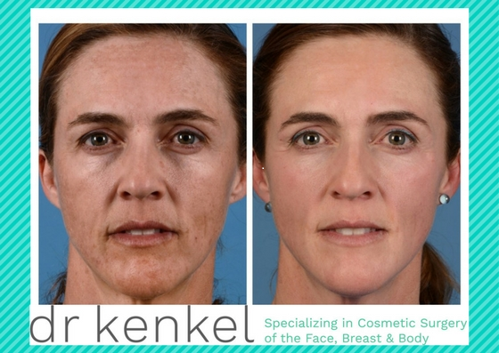 skincare photos drkenkel