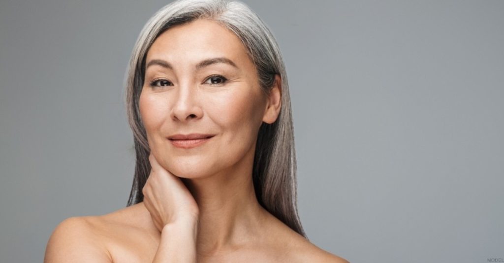 Woman after facelift surgery. (Model)